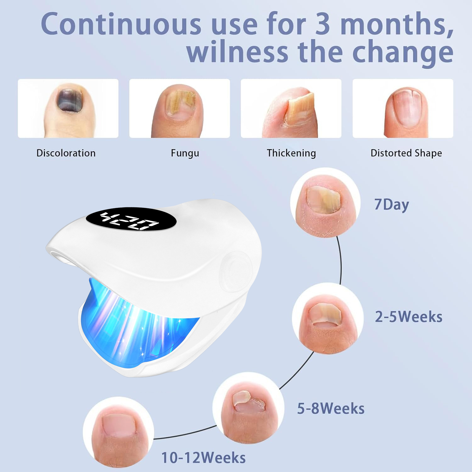 USB Charging Nail Fungus Treat - Skincare Glowing 评论和价格